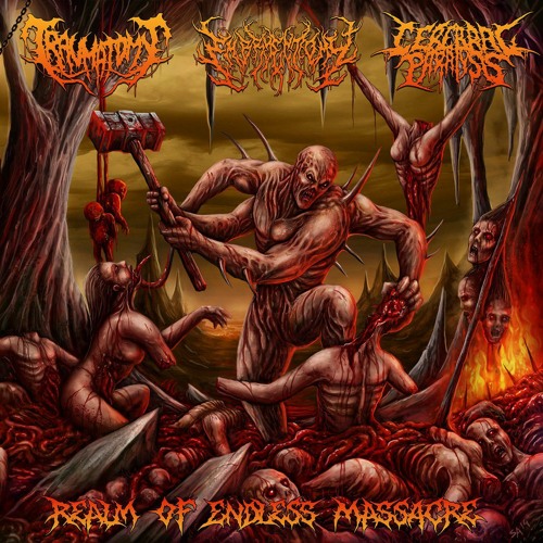 Embryectomy - Molesting the Ominous Abnormity