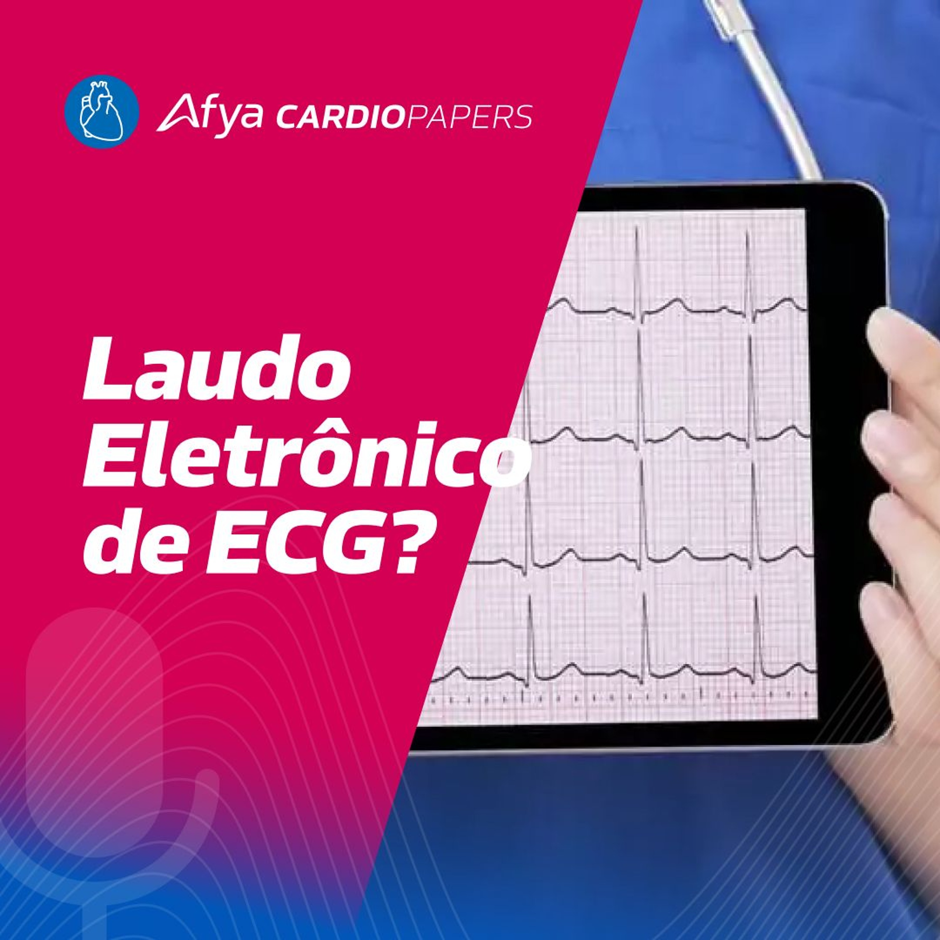 Já podemos confiar nos laudos eletrônicos de ECG? episode artwork