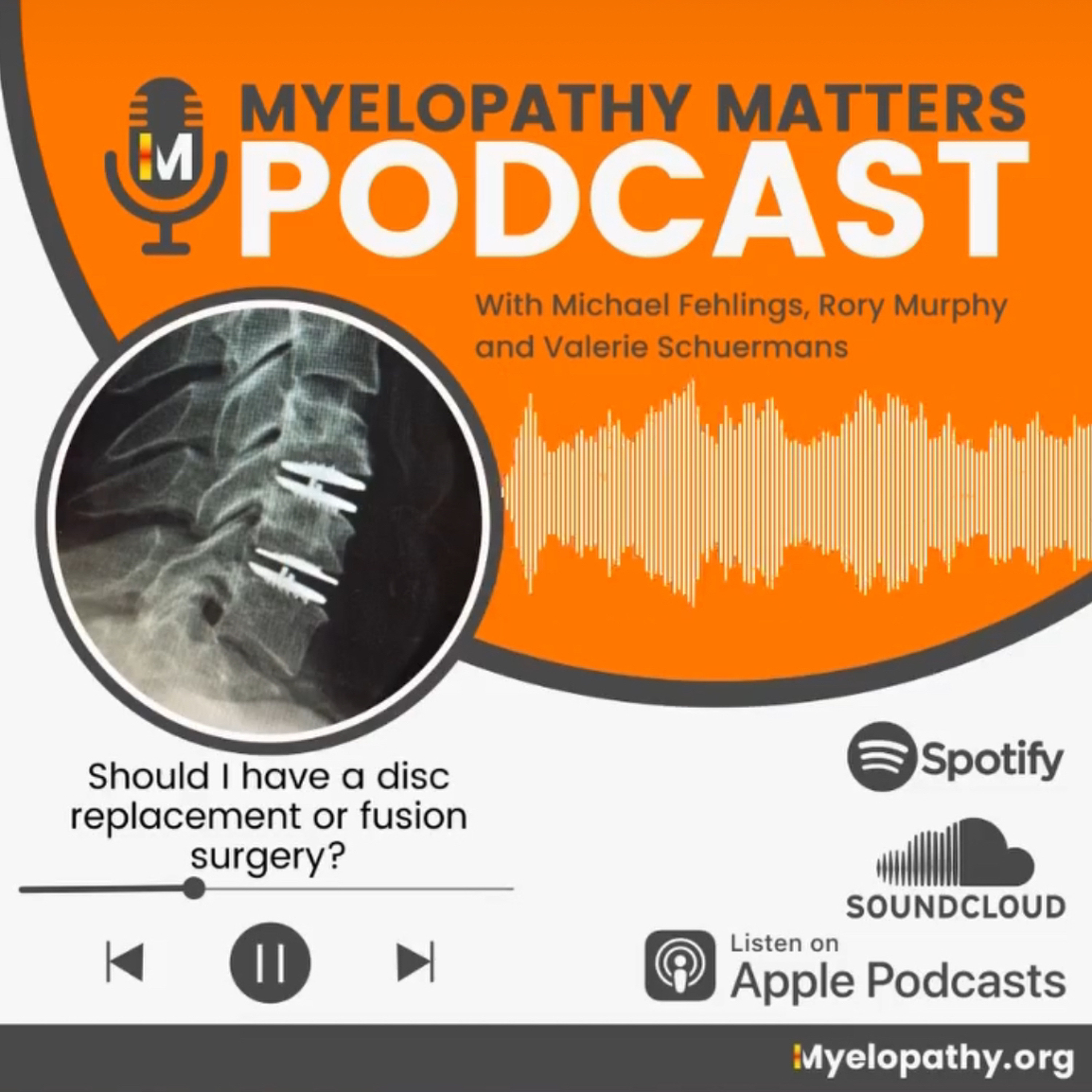 S4E5 - Should I have a disc replacement or fusion surgery?