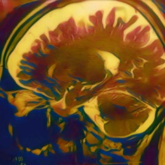 Letter I. To Innocent