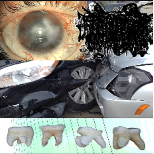 残忍で血まみれの自動車事故