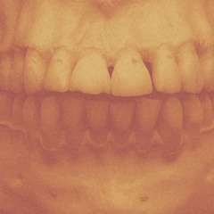 Million Dollar Smile (feat. Knowitall)