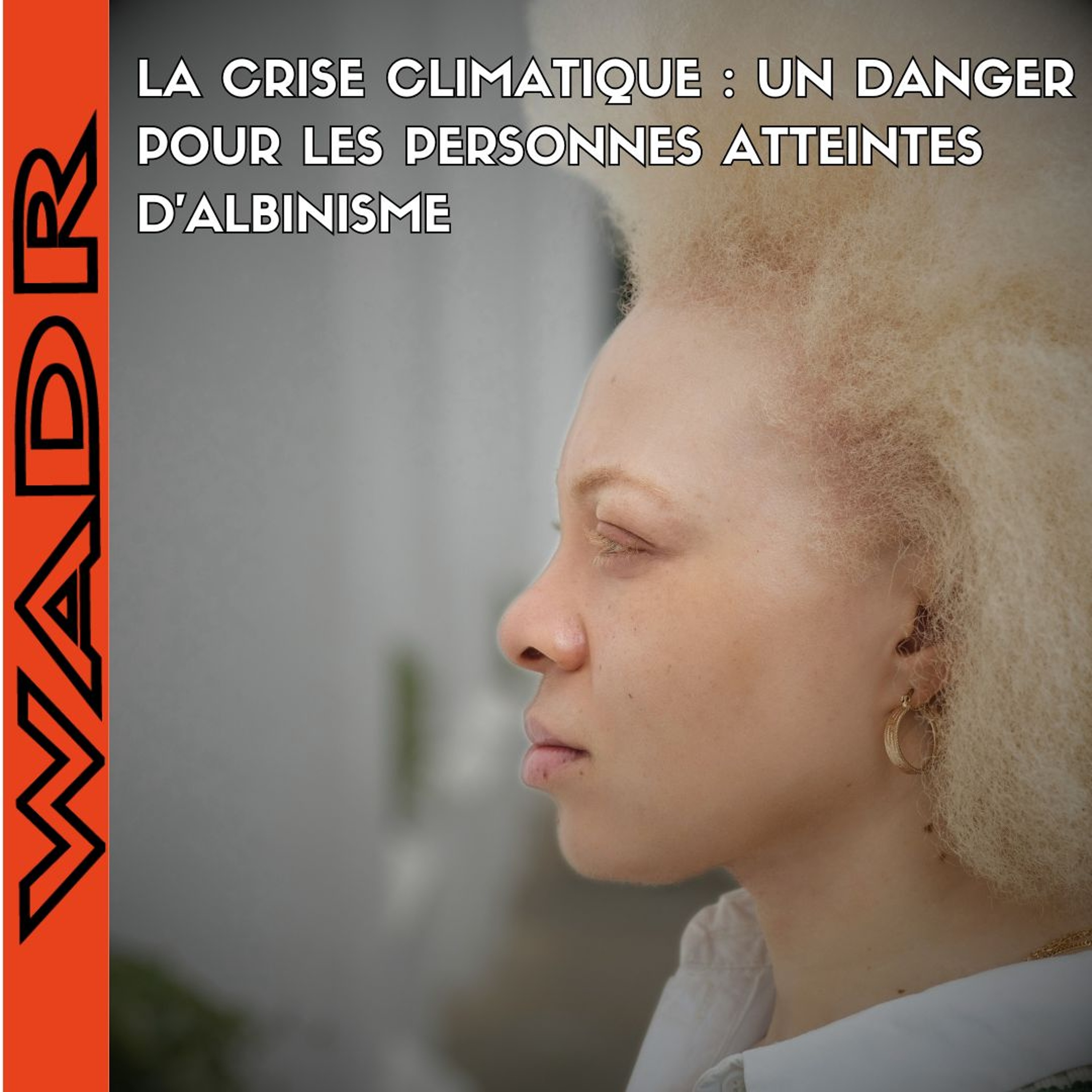 La Crise Climatique : Un Danger pour les Personnes Atteintes D’Albinisme - PLANETERRE episode artwork