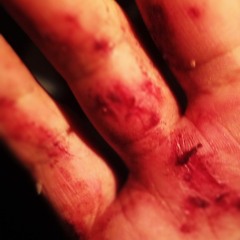 tryna fix my scars w a small azz BandAid