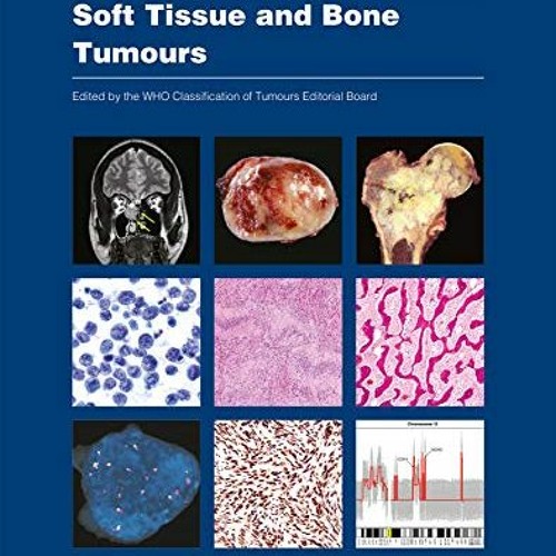 Listen to music albums featuring Open PDF Soft Tissue and Bone Tumours ...