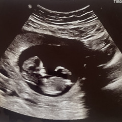 About To Be A Dad - (Feat. ExFold)