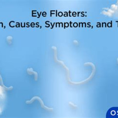 Best Is There A Treatment For Eye Floaters Reviews