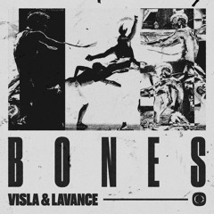 Bones