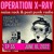 Artwork for OPERATION XRAY EP 55 - JUNE 10, 2022