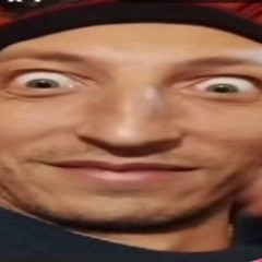 Why stuni is so dark