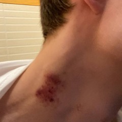 Фристайло клубешный