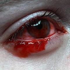 Bravoo HunnidZ - Two Eyes (JvggRadio: Exclus!ve)