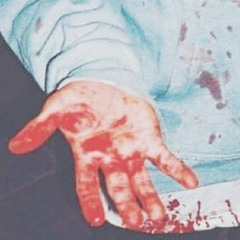 █Reliable Antidotes(prod. VARELA KATANA)