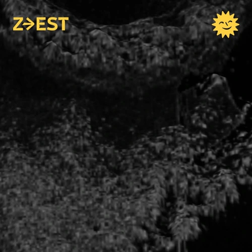 Barthymétrie - Lude invite Animalist - 18/ Soundcloud podcast image for