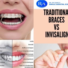 How to Choose Between Dental Braces vs. Clear Braces or Invisalign?