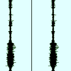 overtonal syndrone martini
