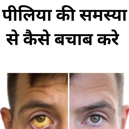 How to prevent the problem of jaundice