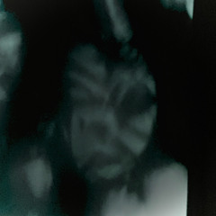 The X continues underground