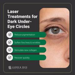 Best Dark Eye Laser Treatment Reviews