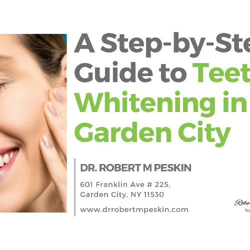A Step-by-Step Guide to Teeth Whitening in Garden City
