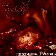 Vulvectomy -  Festering Detached Genitals