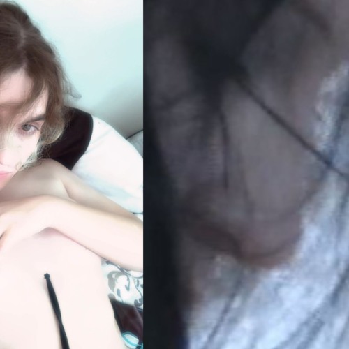 Selfharm