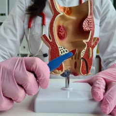 Top Clinics for The Best Piles Treatment in India | Dr Deepika's Homeopathy