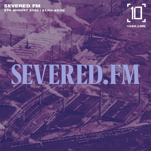 Severed FM For 1020 Radio