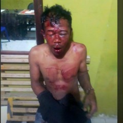 di hantam PAQUITO x EUDORA #lembakkalibah