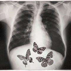 butterflies
