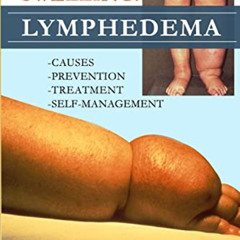 free KINDLE 💚 It's Not Just a Swelling! Lymphedema: Causes, Prevention, Treatment, S