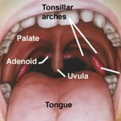 Stream Why Do I Get White Spots On My Teeth When I m Sick TOP By stream-why-do-i-get-white-spots-on-my-teeth-when-i-m-sick-top-by