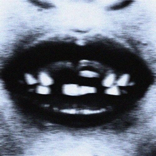 Broken Teeth