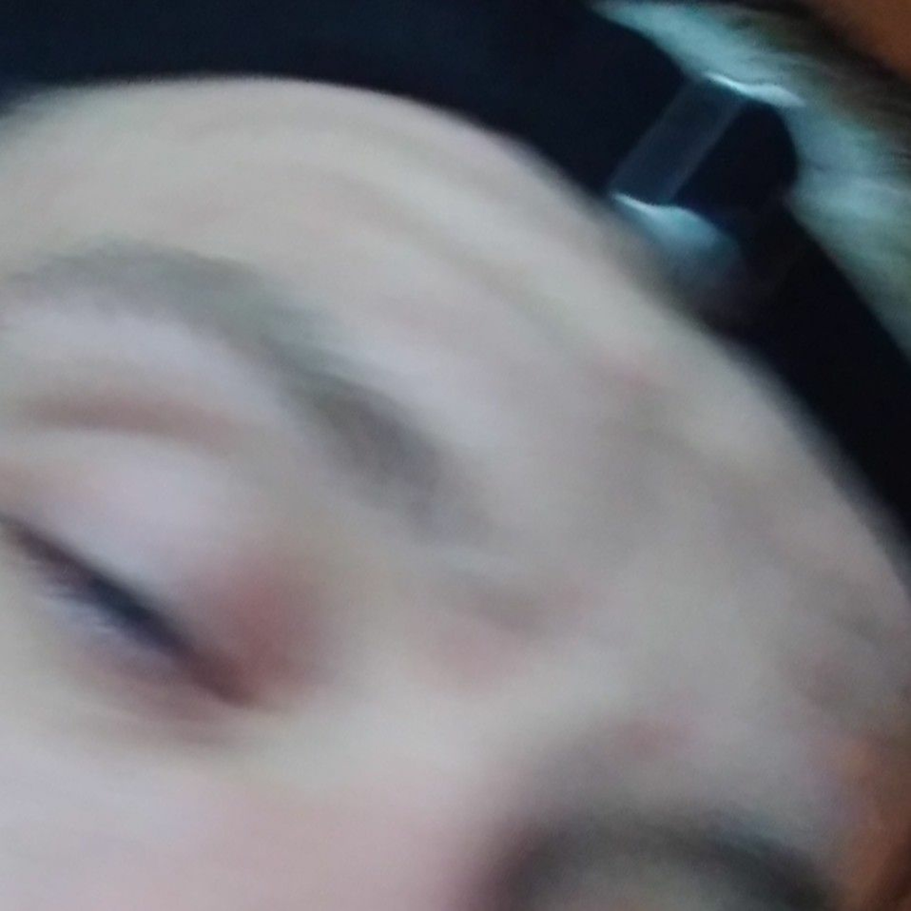 NalyDx