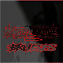 NoiZeTekk_live feat. Sinéad Whyte - Bruises