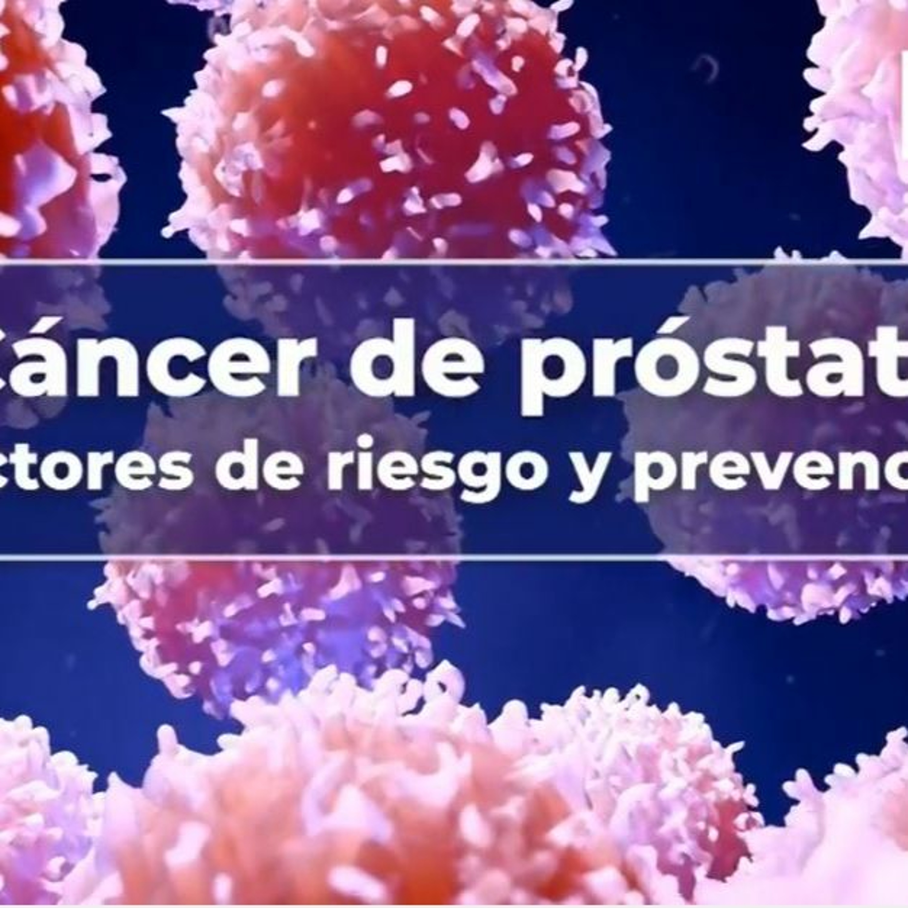 Dr. Gilberto Ruiz Deyá - Cáncer De Próstata