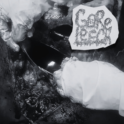 Oozing liquid coming out of the pericardial sac