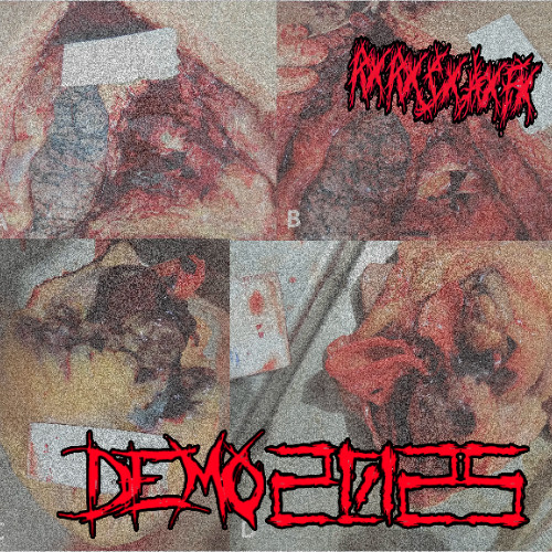 Skill issue to the disabled