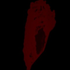 Heartbreak Melody by DakiddDame w/ Juicewrld cover