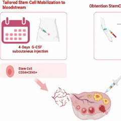 Stem Cell Treatment Shows Potential for Restoring Fertility in Women with Ovarian Failure