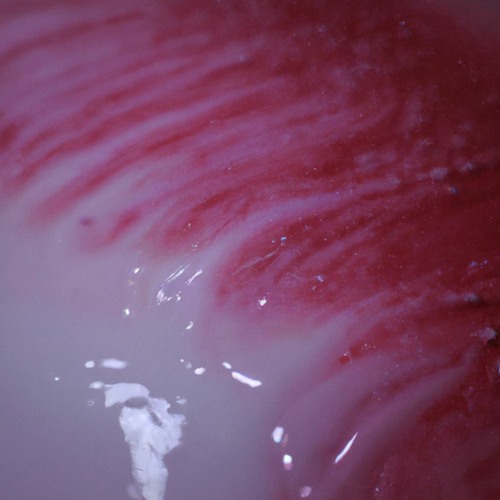 M7 - X004 (Parasite)