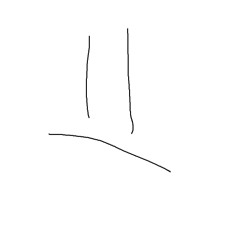 Freedom From the Toilet