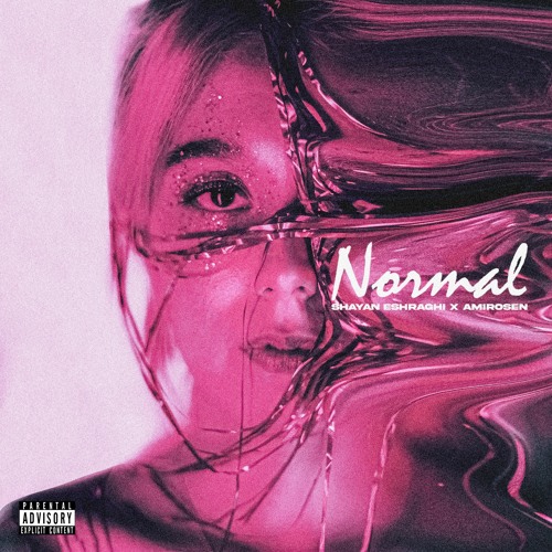 Normal