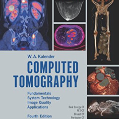 ACCESS KINDLE 📂 Computed Tomography: Fundamentals, System Technology, Image Quality,