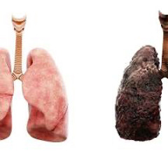 LUNGS