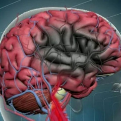 Veja os cuidados para se prevenir do AVC: doença cresce entre mulheres com menos de 50 anos