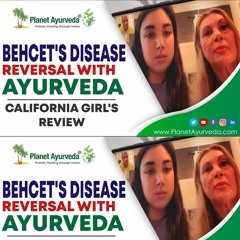 Behcet's Disease Successful Treatment at Planet Ayurveda - California Girl's Review