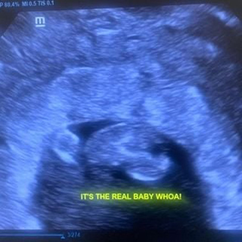 #BRB ##KAP5L ##NLTAB