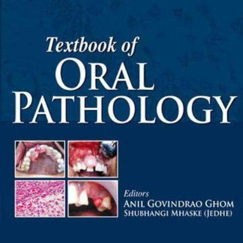 [GET] EBOOK 🗸 Textbook of Oral Pathology by  Anil Govindrao Ghom [KINDLE PDF EBOOK E