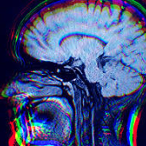 Dopamine